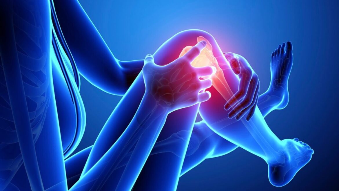 Was ist Arthrose: Hilfe bei Gelenkentzündungen