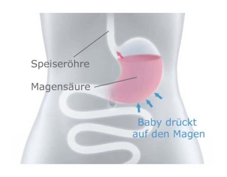 Schwangerschaft Sodbrennen: Die möglichen Ursachen